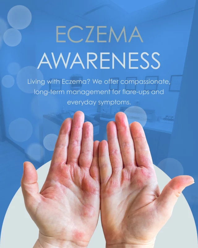 Eczema doesn’t have to control your life.

From personalized treatment plans to ongoing support, we help patients manage chronic eczema with confidence and clarity.

Relief starts with the right diagnosis and care. Let’s talk about your options.

#dermatology #selfcare #health #beautycare #thisisnoteczema #skincareroutine