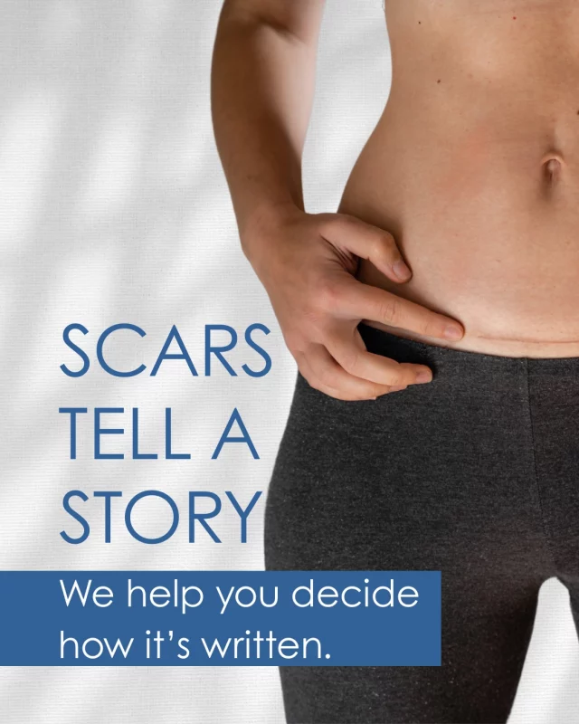 Whether from acne, surgery, or injury—scars don’t have to be permanent.

We offer a variety of scar treatment solutions, including microneedling, laser therapy, and topical care options tailored to your skin.

Let’s create a treatment plan that works for you.

#dermatology #cosmeticdermatology #dermatologist #laser #antiaging #cosmetics #diagnostics