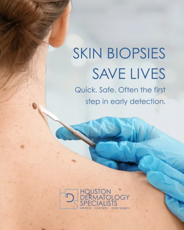 A biopsy may sound intimidating, but it’s a simple, quick, and essential part of catching skin conditions early, especially skin cancer.

If something looks or feels off, don’t wait. Let’s take a closer look.

#medicalskincare #derm #skincare #laser #antiaging #cosmetics #diagnostics #acnetreatment