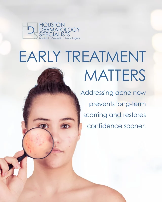 Acne is one of the most common skin conditions, but delaying treatment can lead to lasting scars and frustration.

Our dermatologists provide early, effective care designed to stop breakouts and protect your skin for the future.

Clear skin begins with expert guidance.

#medicalskincare #derm #skincare #laser #antiaging #cosmetics #diagnostics #acnetreatment