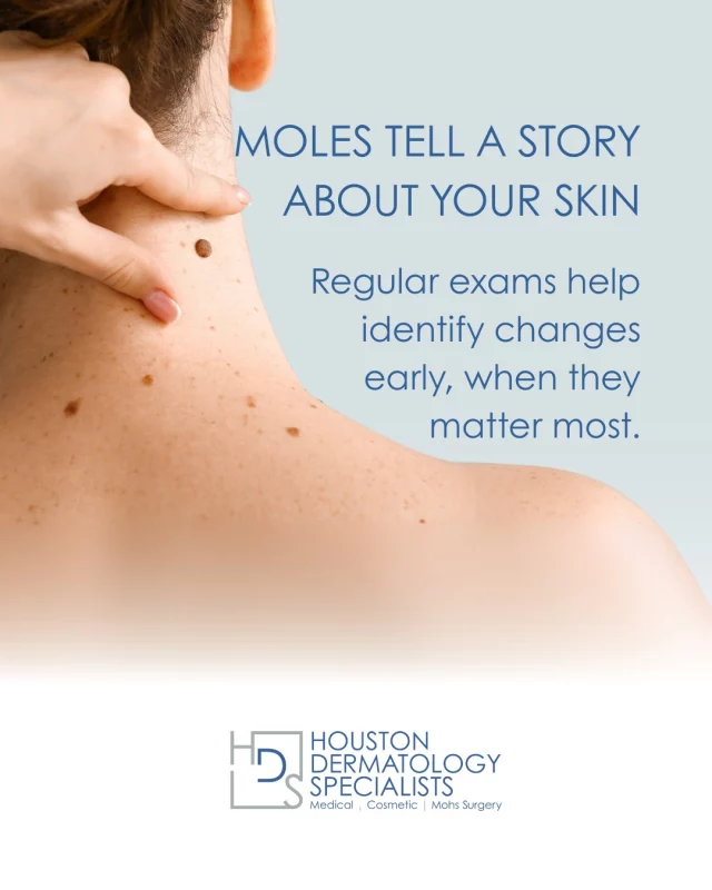 A changing mole may be harmless, or it may be a sign of something more serious.

Routine mole checks give us the opportunity to catch concerning spots early and provide peace of mind.

Your skin deserves careful attention

#MohsSurgery
#PostOpCare
#SkinCancerTreatment #medicalskincare #derm #skincare