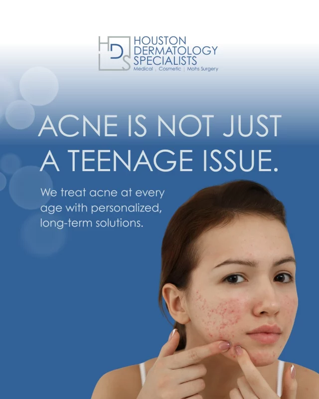 Acne can affect your confidence at any stage of life.

From teens navigating hormones to adults dealing with stress or medication triggers, we build care plans that address your skin’s specific needs.

There is no shame in seeking support.

 #cosmetics #diagnostics #acnetreatment