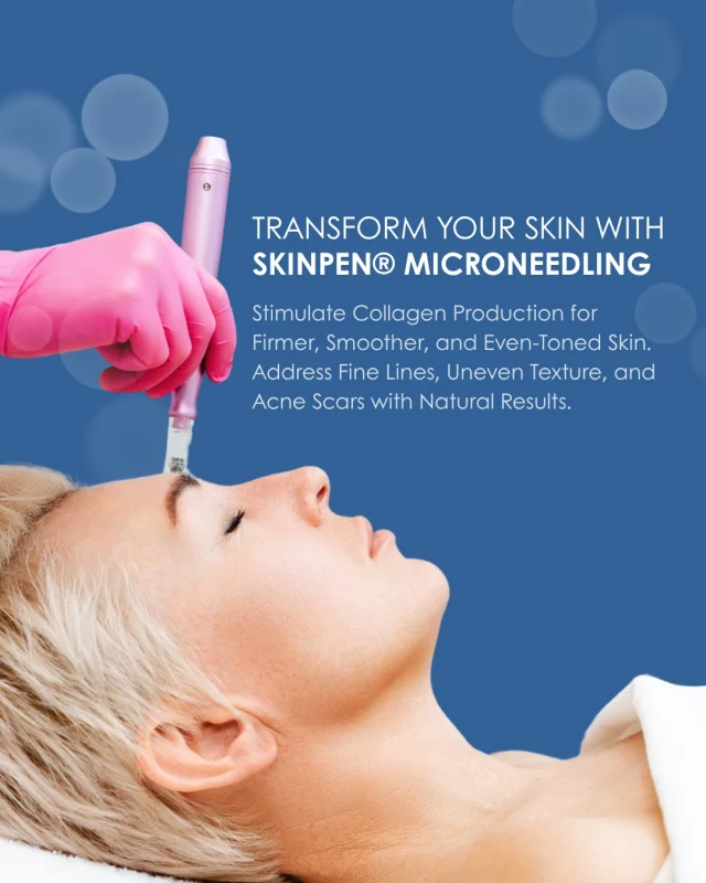 If you're looking to smooth out fine lines, improve uneven texture, or reduce acne scars, SkinPen® Microneedling is the solution you’ve been waiting for. This minimally invasive treatment stimulates your skin’s natural healing response, triggering collagen production for smoother, firmer, and more youthful-looking skin.

SkinPen® is a versatile treatment that can address a variety of skin concerns, from fine lines to acne scars, giving you natural and lasting results. Whether you're treating specific problem areas or revitalizing your entire complexion, our team at Houston Dermatology Specialists will tailor the treatment to your skin's unique needs.

🌟 Ready for rejuvenated, glowing skin? Book your consultation today: www.houstondermatologyspecialists.com

#houstondermatologyspecialists #skinpenmicroneedling #microneedling #acnescars #fine_lines #eventexture #smoothskin #collagenboost #youthfulglow #cosmeticdermatology