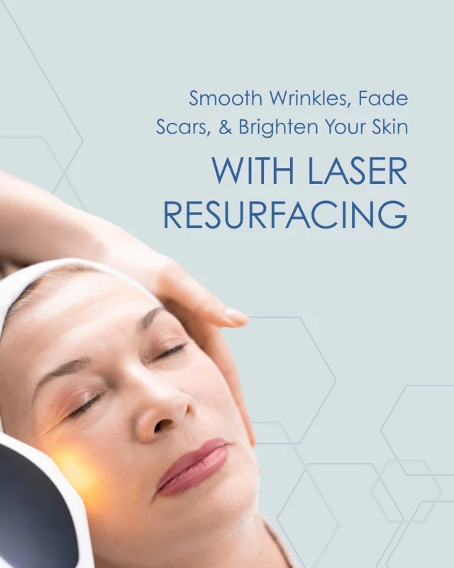 Want to reveal smoother, younger-looking skin? At Houston Dermatology Specialists, we offer advanced laser skin treatments like the CO2RE® and LUCENT IPL lasers to tackle a wide range of skin concerns. From fine lines and wrinkles to acne scars and sun damage, our lasers stimulate your skin’s natural healing process to give you healthier, glowing skin.

Laser skin resurfacing is quick, effective, and minimally invasive, with little to no downtime. Plus, our double board-certified dermatologists: Dr. Christopher Downing, Dr. Joel Byrne, and Dr. Rachel Gordon; are here to guide you every step of the way.

Whether you’re looking to reduce pigmentation, smooth texture, or tighten skin, our team will create a customized treatment plan just for you.

Ready to love your skin again? 
🌟 Book a consultation today: www.houstondermatologyspecialists.com

#houstondermatologyspecialists #laserskincare #co2laser #ipltherapy #youthfulskin #radiantskin #acnescars #skincarejourney #skintreatment #smoothskin