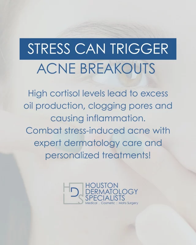 Did you know that stress is a major culprit behind acne flare-ups? When you're under stress, your body produces more cortisol, which leads to an increase in oil production. This excess oil can clog your pores, resulting in breakouts and irritated skin. 😓

But don’t worry, there’s a solution! At Houston Dermatology Specialists, we offer effective treatments that target acne at its source. Whether you're dealing with hormonal acne, stress-related breakouts, or stubborn scarring, our team of expert dermatologists, Dr. Christopher Downing, Dr. Joel Byrne, and Dr. Rachel Gordon, will help create a treatment plan tailored to your unique skin.

Our services include:
🌿 Medical-grade acne treatments
🌿 Chemical peels to exfoliate and reduce inflammation
🌿 Laser therapies to minimize scarring and reduce oil production
🌿 Microneedling to rejuvenate and smooth the skin

Don't let stress control your skin. Let us help you get clearer, healthier skin!

🌟 Ready to say goodbye to acne? Book your consultation today: www.houstondermatologyspecialists.com

#houstondermatologyspecialists #acnetreatment #stressandacne #skincarehelp #clearerskin #dermatologycare #acnesolutions #skincarejourney #confidentyou #healthyskin