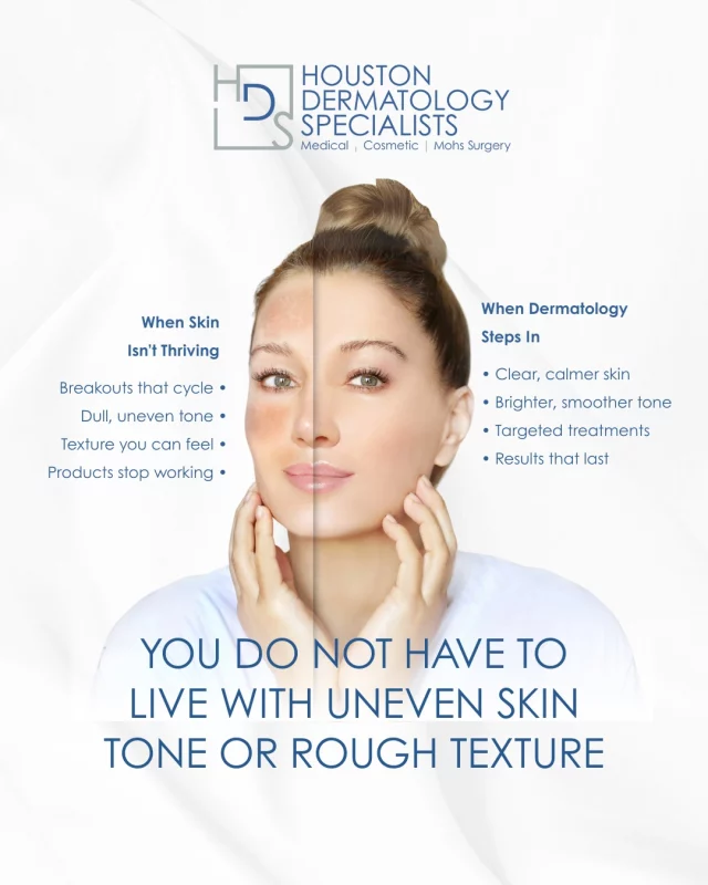 Sometimes your skin struggles because it’s missing one thing: professional guidance.
When concerns like acne, texture, pigmentation, or premature aging keep coming back, it’s a sign your skin needs more than over-the-counter solutions.

Our team at Houston Dermatology Specialists provides personalized, science-backed treatments, from lasers and microneedling to BOTOX®, fillers, and medical-grade skincare, that help your skin finally behave, glow, and stay consistent.

✨ Your best skin starts with expert care.
Book your visit today: www.houstondermatologyspecialists.com or link in bio!

#houstondermatologyspecialists #professionalskincare #dermatologyclinic #skincarescience #acnesolutions #lasertreatments #skincarejourney #healthyskinclub #skintransformation #confidenceinyourglow